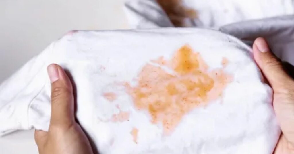 Addressing Stains and Discoloration
